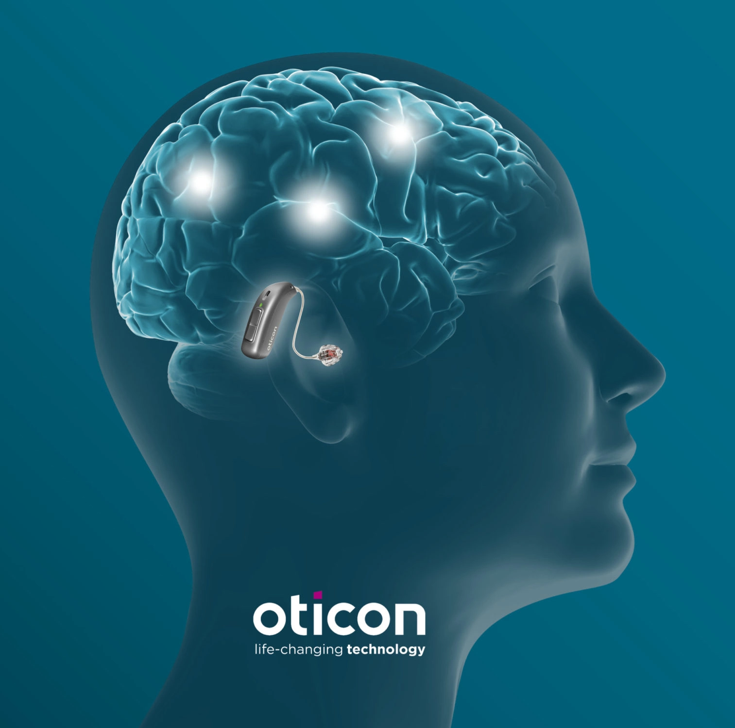 Oticon BrainHearing